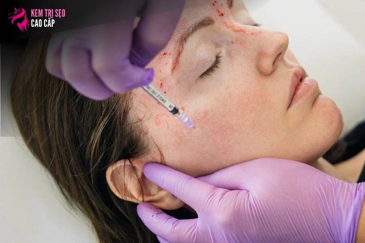 Trị Liệu Bằng Kim Cương và Đá Quý: Biến Làn Da Sạm Màu Thành 